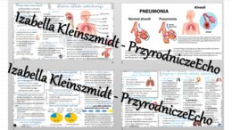 Zestaw sketchnotek – notatek do całego działu „Układ oddechowy” wykonanych w power point do edycji. Biologia 7