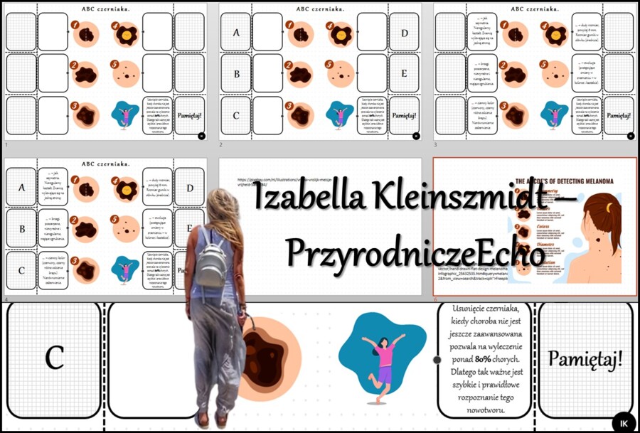 Notatka okienkowa/stacja zadaniowe/notatka/notatka graficzna/karta pracy/sketchnotka „ABC czerniaka”, „Higiena i choroby skóry" w pdf. Biologia 7 dział „Organizm człowieka. Skóra - powłoka organizmu”. Materiał wykonany na podstawie podręcznika z wydawnic