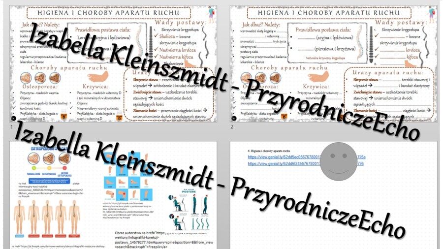Minizestaw na temat „Higiena i choroby aparatu ruchu” – sketchnotka + karta pracy w power point + gratisowy link do prezentacji multimedialnej niekomercyjnej wykonanej w genial.ly do indywidualnego pobrania i użycia do celów niekomercyjnych. Biologia 7, 