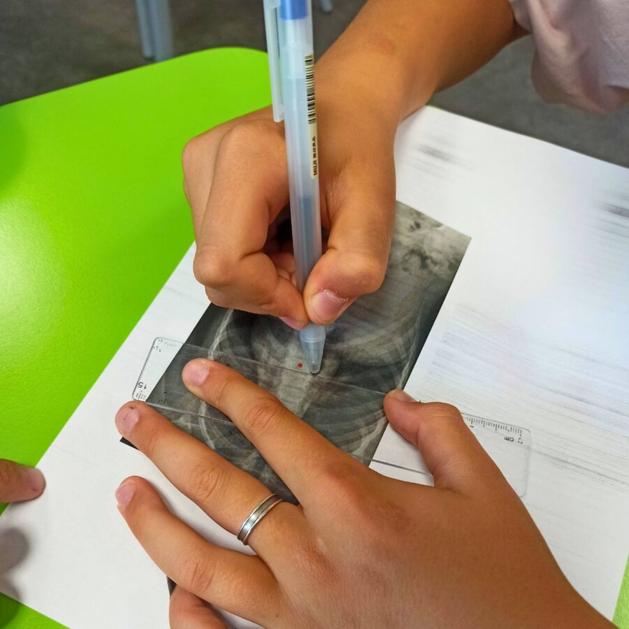 LEKCJA O SKOLIOZIE - MIERZENIE KĄTÓW