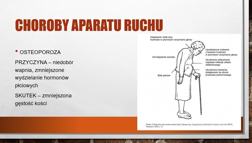 Higiena i choroby aparatu ruchu
