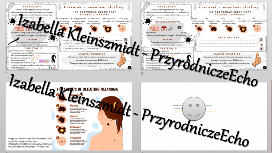 Minizestaw na temat „Czerniak - złośliwy nowotwór skóry” – sketchnotka + karta pracy w power point + gratisowy link do prezentacji multimedialnej niekomercyjnej wykonanej w genial.ly do indywidualnego pobrania i użycia do celów niekomercyjnych. Biologia 