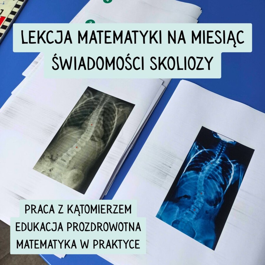 LEKCJA O SKOLIOZIE - MIERZENIE KĄTÓW