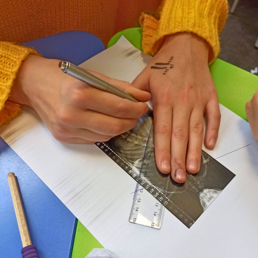 LEKCJA O SKOLIOZIE - MIERZENIE KĄTÓW