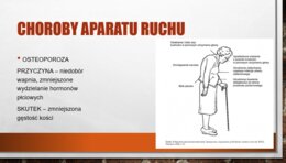 Higiena i choroby aparatu ruchu