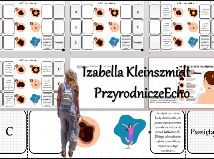 Notatka okienkowa/stacja zadaniowe/notatka/notatka graficzna/karta pracy/sketchnotka „ABC czerniaka”, „Higiena i choroby skóry" w pdf. Biologia 7 dział „Organizm człowieka. Skóra - powłoka organizmu”. Materiał wykonany na podstawie podręcznika z wydawnic