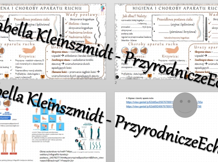 Minizestaw na temat „Higiena i choroby aparatu ruchu” – sketchnotka + karta pracy w power point + gratisowy link do prezentacji multimedialnej niekomercyjnej wykonanej w genial.ly do indywidualnego pobrania i użycia do celów niekomercyjnych. Biologia 7, 