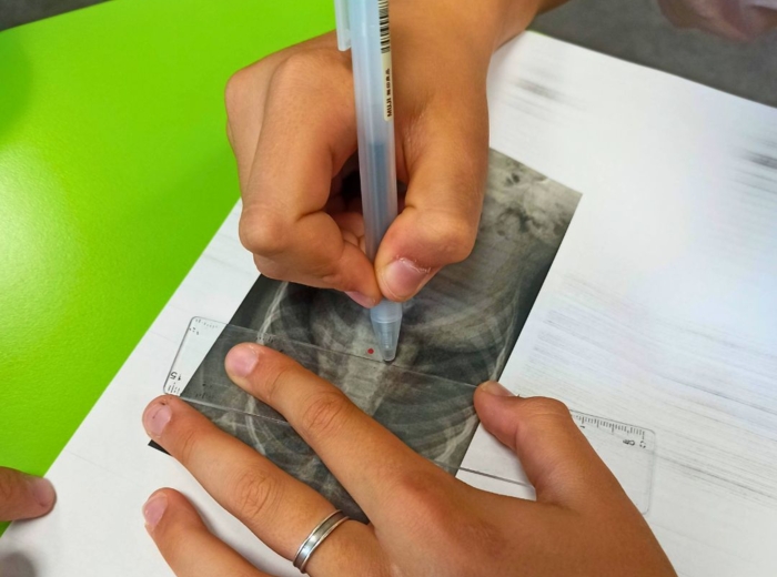 LEKCJA O SKOLIOZIE - MIERZENIE KĄTÓW