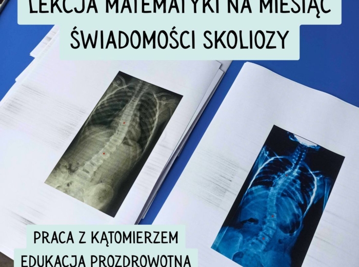 LEKCJA O SKOLIOZIE - MIERZENIE KĄTÓW