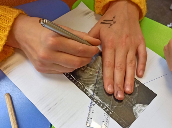 LEKCJA O SKOLIOZIE - MIERZENIE KĄTÓW