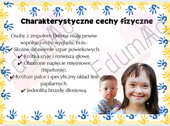 Światowy Dzień Zespołu Downa 21 marca