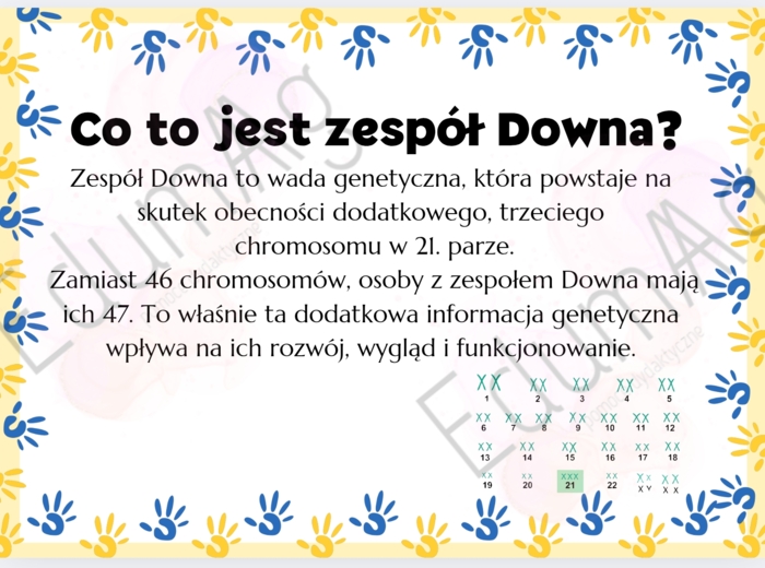 Światowy Dzień Zespołu Downa 21 marca
