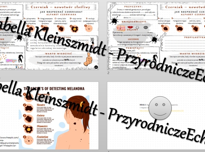 Minizestaw na temat „Czerniak - złośliwy nowotwór skóry” – sketchnotka + karta pracy w power point + gratisowy link do prezentacji multimedialnej niekomercyjnej wykonanej w genial.ly do indywidualnego pobrania i użycia do celów niekomercyjnych. Biologia 